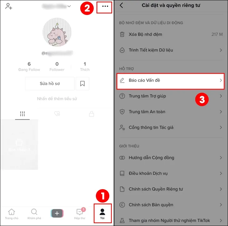 Giao diện tùy chọn tài khoản TikTok, nơi người dùng báo cáo sự cố về tính năng Cách live trên điện thoại.