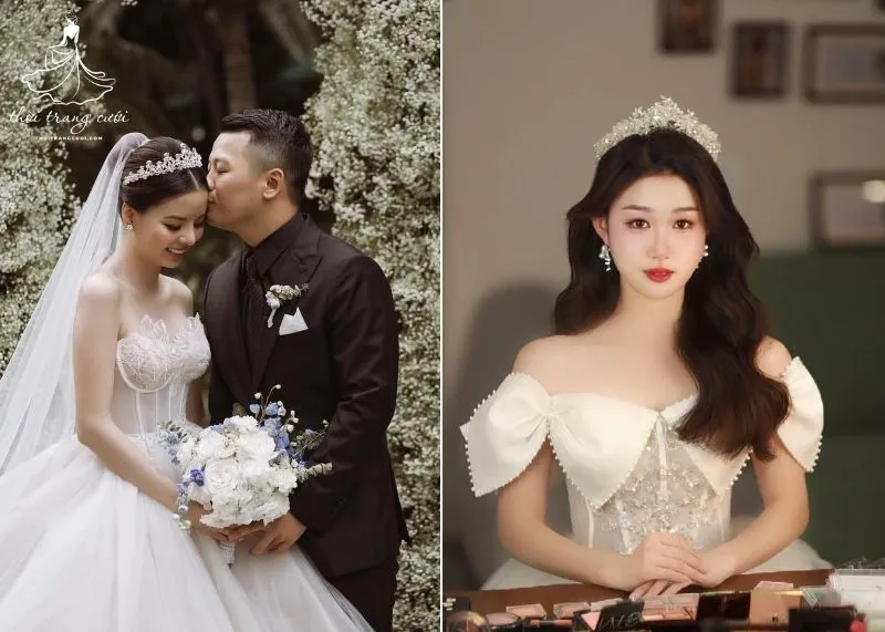 Quy trình cố định vương miện dáng comb bằng kẹp tăm